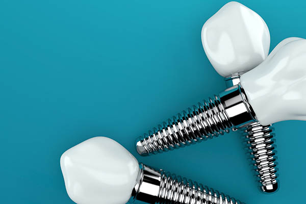 What Happens After Dental Implants Are Placed?